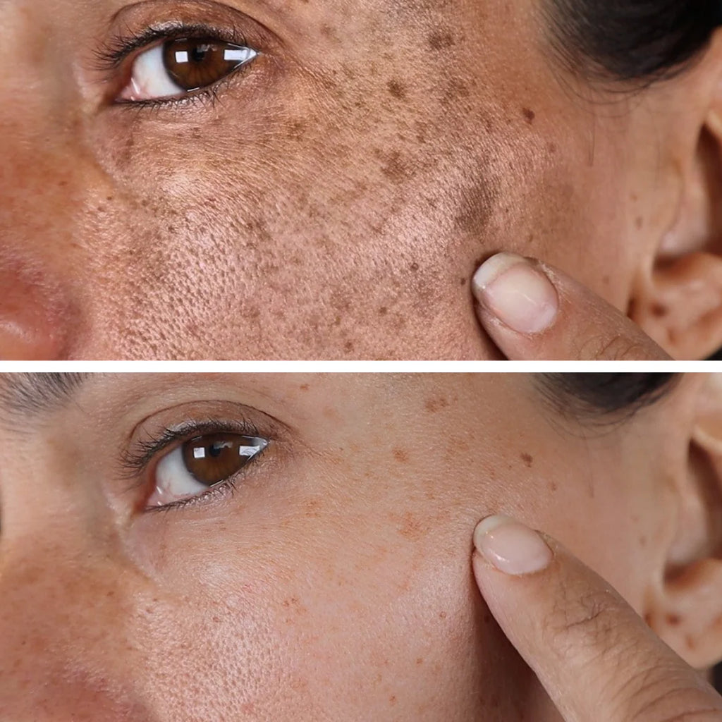 Corrector de Manchas Séline